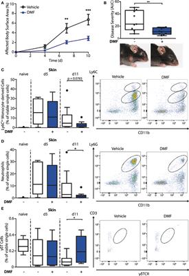 The Immunometabolomic Interface Receptor Hydroxycarboxylic Acid Receptor 2 Mediates the Therapeutic Effects of Dimethyl Fumarate in Autoantibody-Induced Skin Inflammation